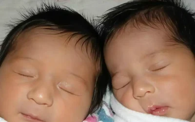 A twin birth with the midwives